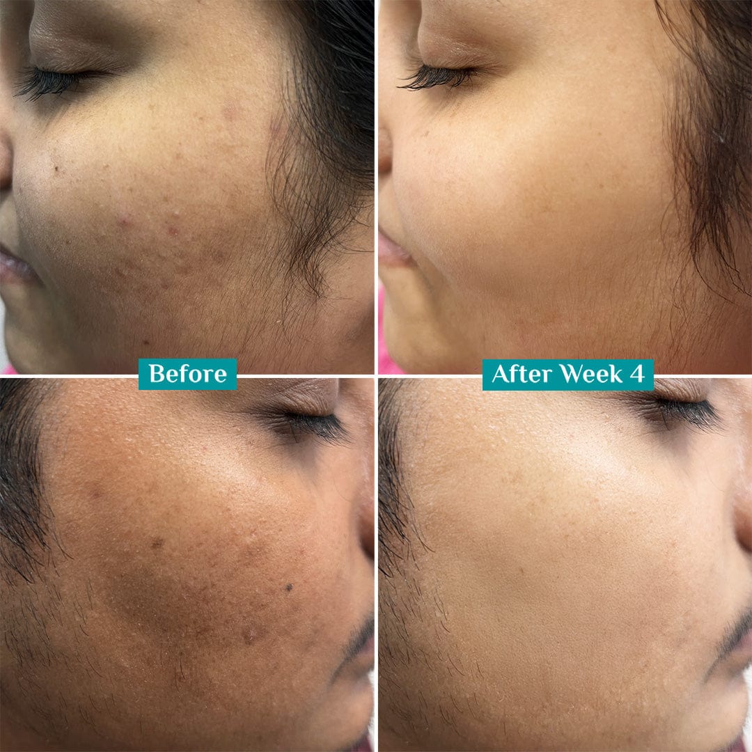 10% Vitamin C Face Serum For Triple Glow+++ - Image 10