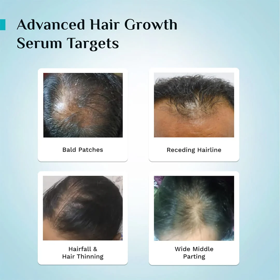 3% Redensyl, 4% Anagain & 5% Capilia Stem Cell Complex Advanced Hair Growth Serum - 50ml - Image 11