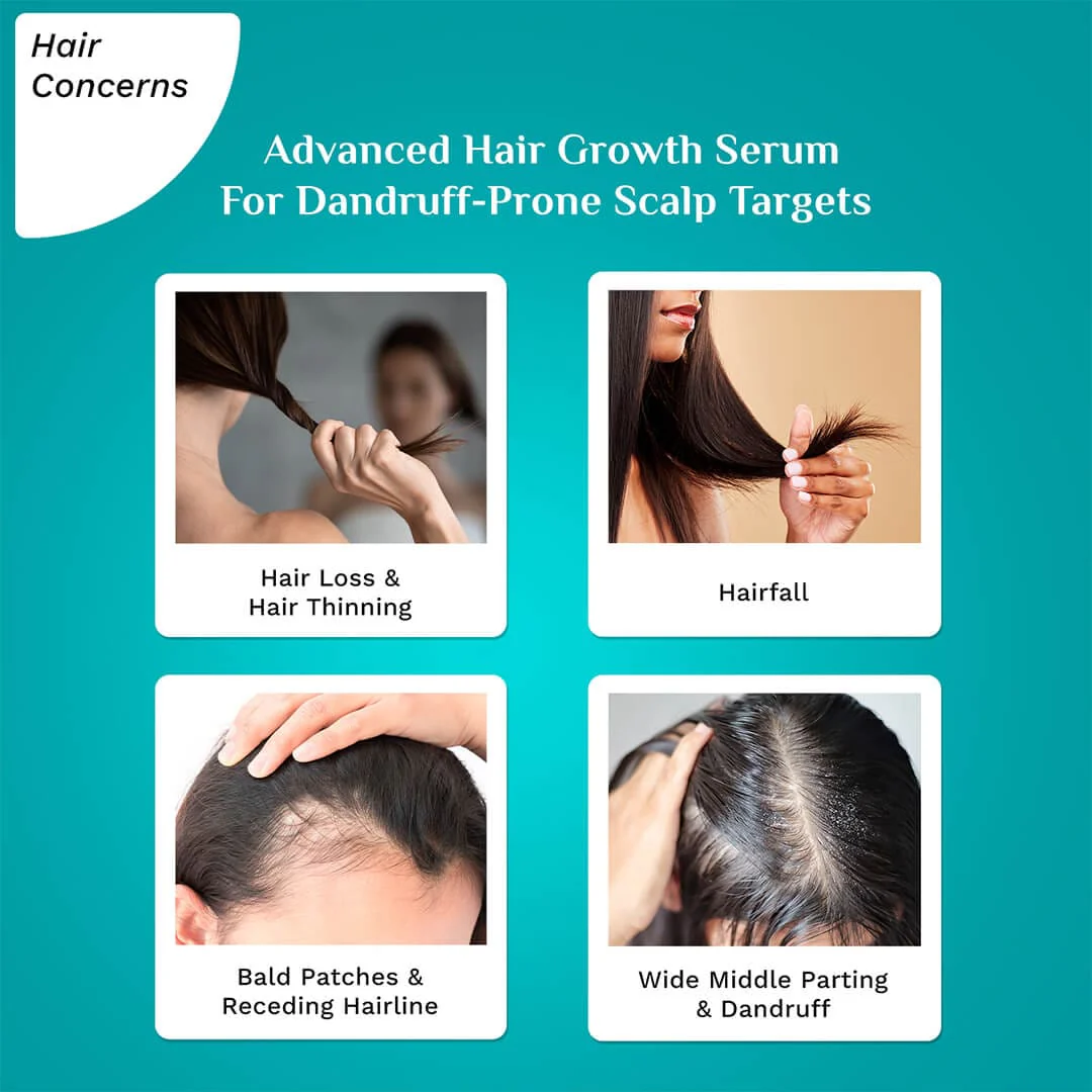 3% Redensyl & 4% Anagain Advanced Hair Growth Serum For Dandruff-Prone Scalp - 30 ml - Image 4