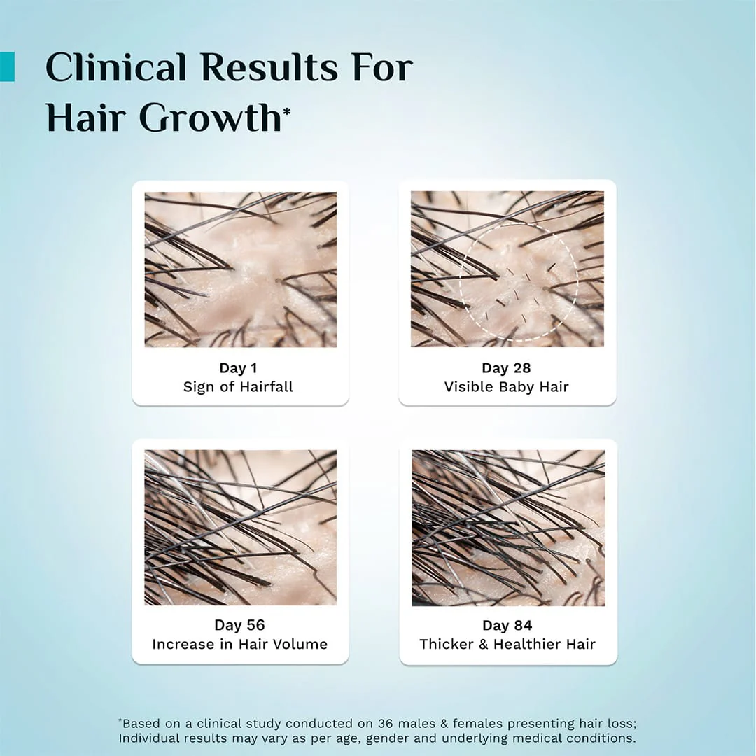 3% Redensyl, 4% Anagain & 5% Capilia Stem Cell Complex Advanced Hair Growth Serum - Image 34