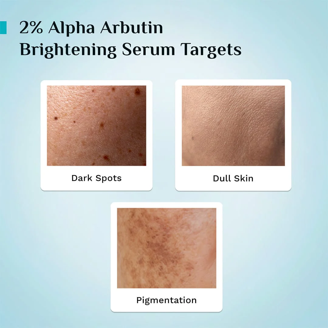 2% Alpha Arbutin Brightening Serum - Image 7
