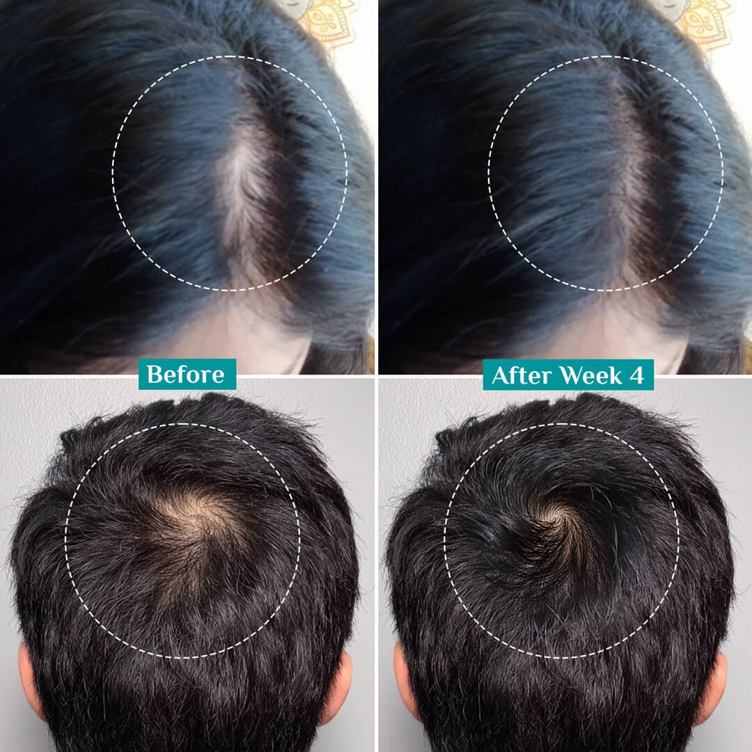 3% Redensyl, 4% Anagain & 5% Capilia Stem Cell Complex Advanced Hair Growth Serum - Image 28