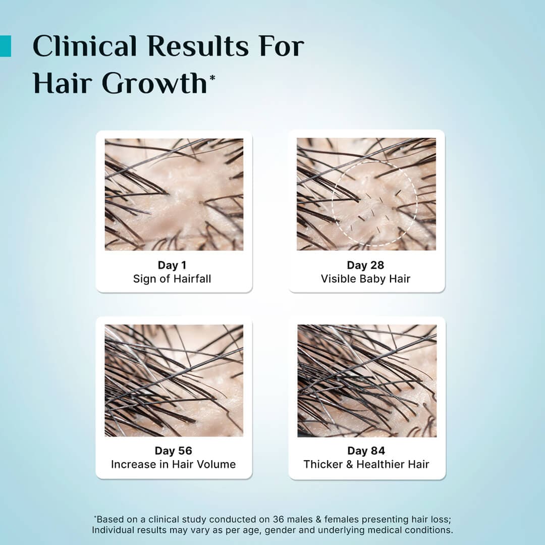 3% Redensyl, 4% Anagain & 5% Capilia Stem Cell Complex Advanced Hair Growth Serum - Image 33