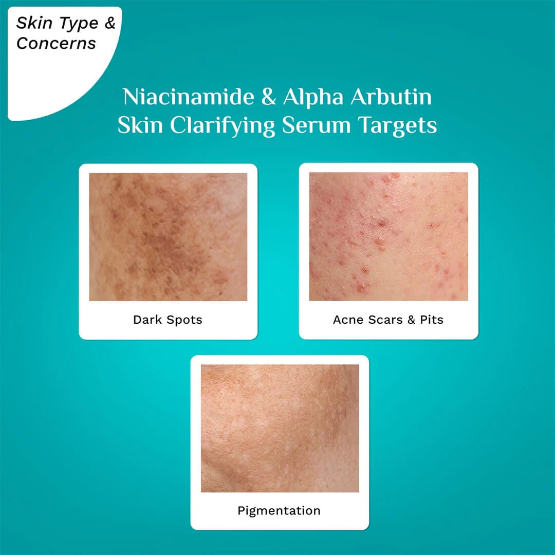 Niacinamide & Alpha Arbutin Skin Clarifying Serum - Image 6